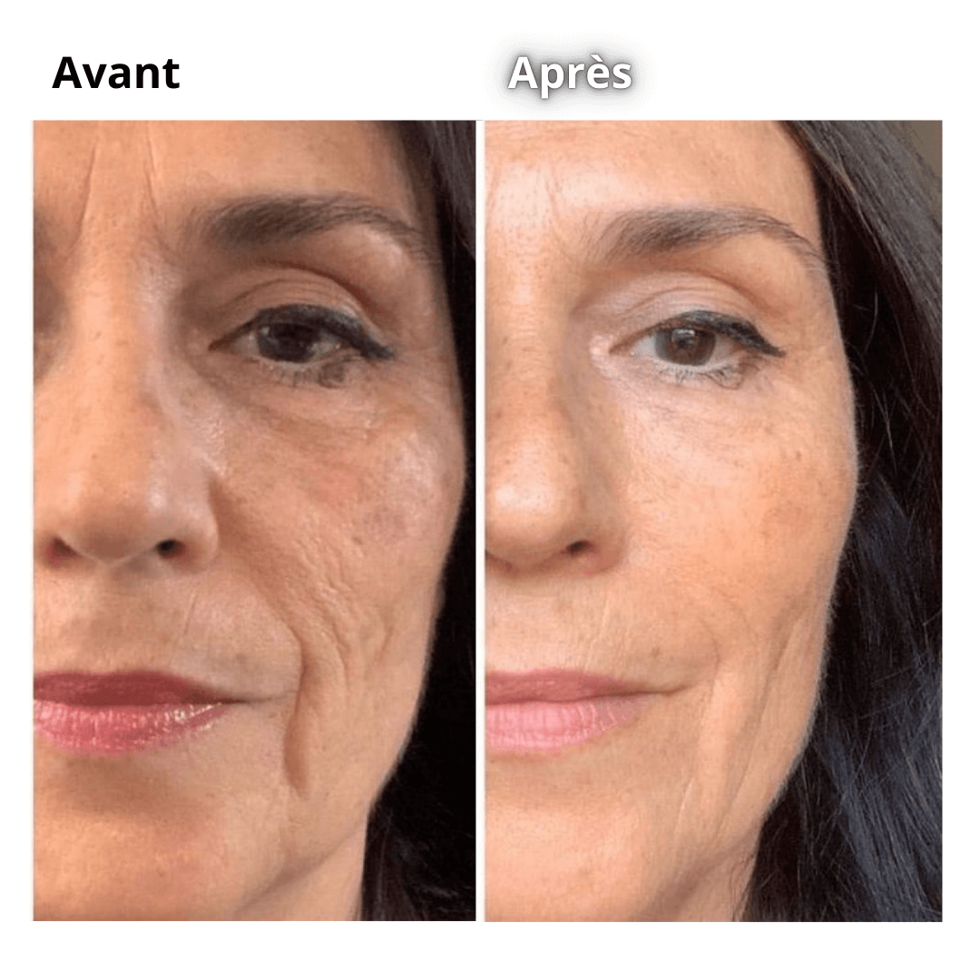 LUMISTICK - The secret to radiant and firm skin in 5 minutes